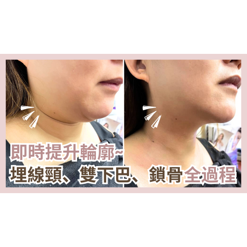 Youtube Thumbnail (1)