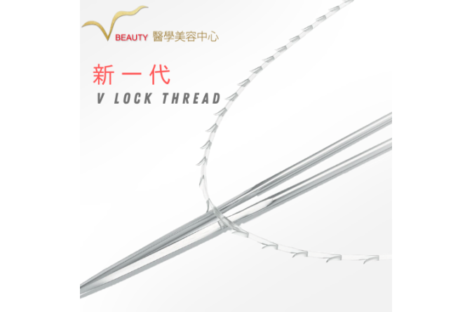 V lock thread