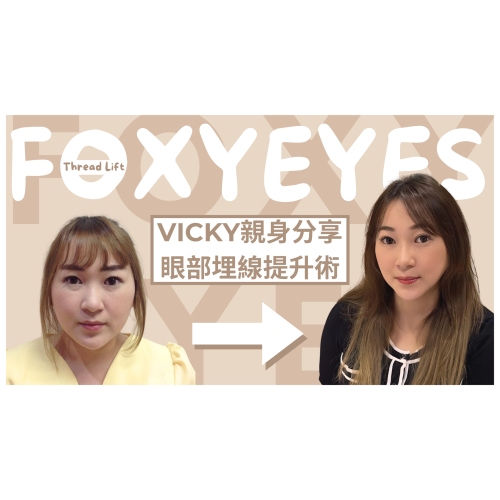 V Beauty Before &amp; After (1)