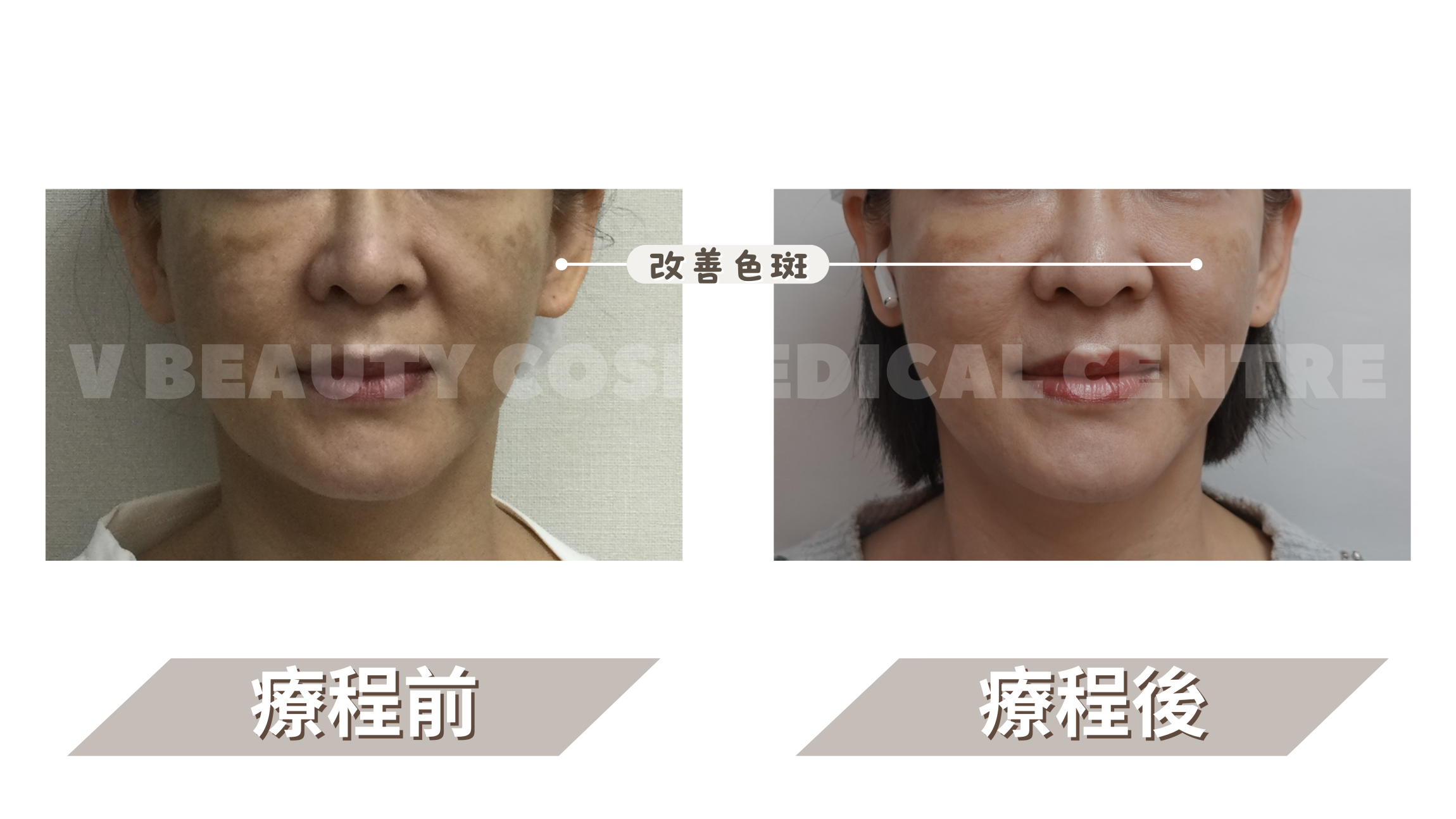 本页图片/档案 - B&A -2