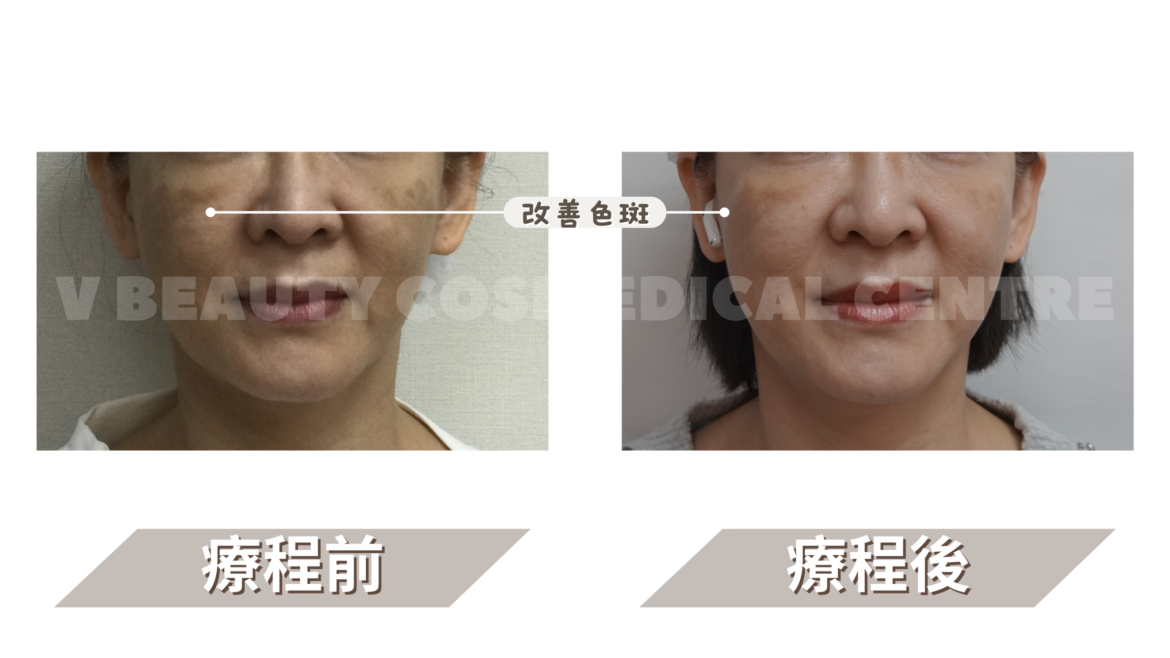 本页图片/档案 - B&A -1