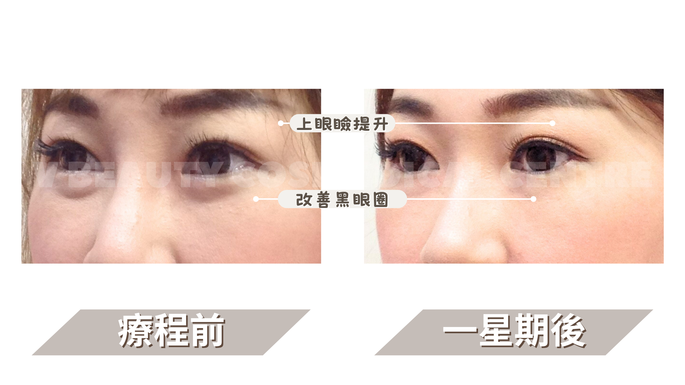 本页图片/档案 - DRT Before & After (1)