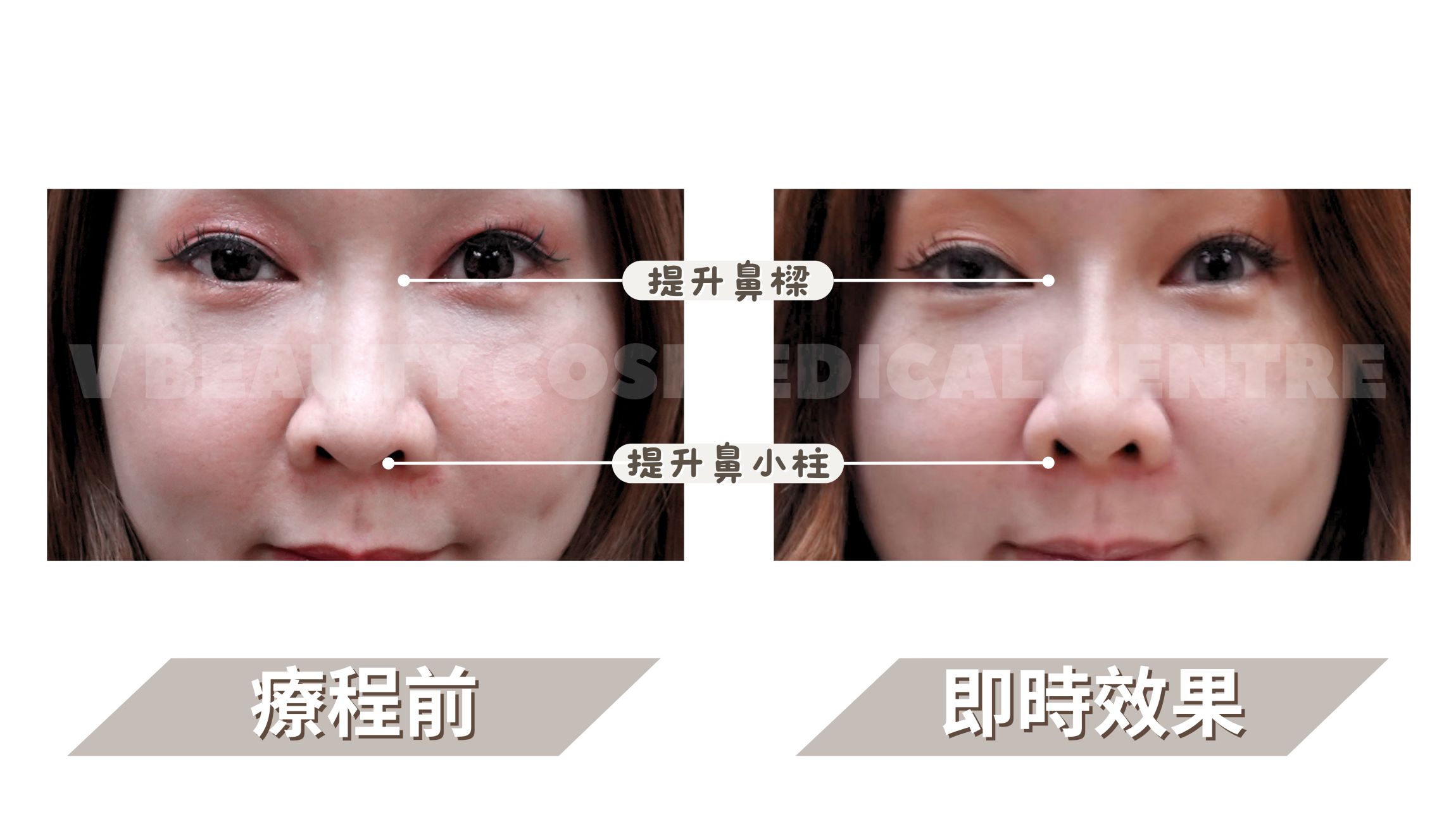 本页图片/档案 - DRT Before & After 的复本