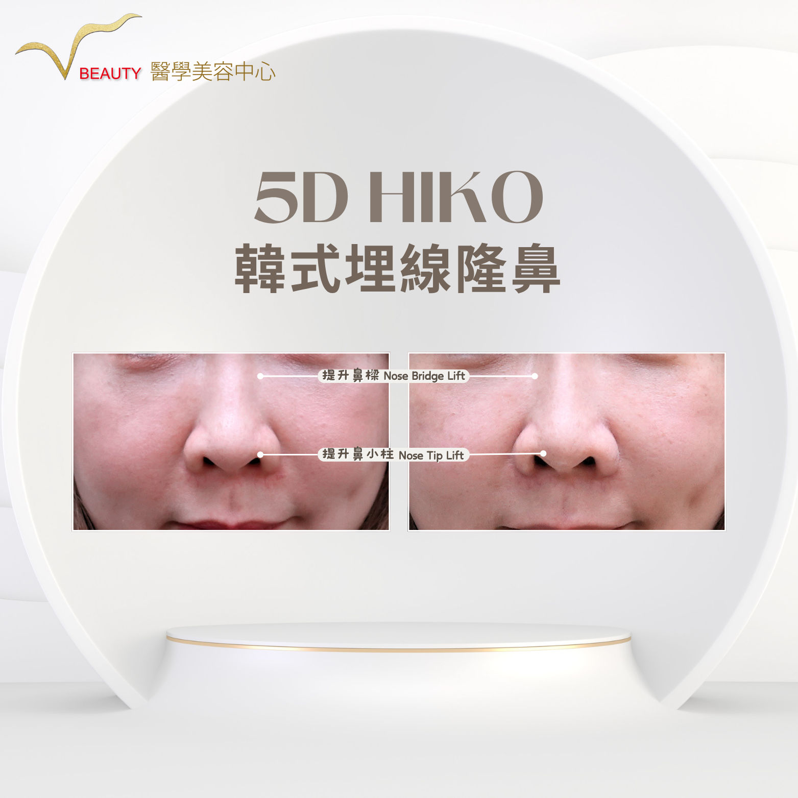 5d HiKO